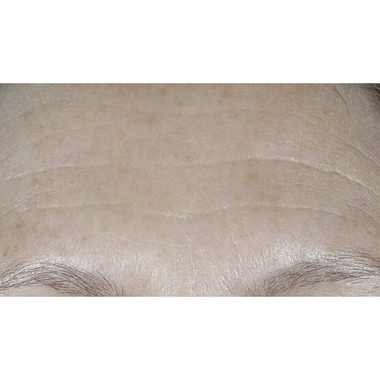 SMART SPF WRINKLE CREAM 50ML