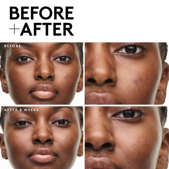 Kit Fenty Skin Start&rsquo;r Set Mineral Refresh para Peles Normais &agrave; Oleosas