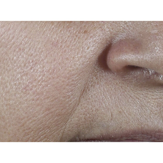 SMART SPF WRINKLE CREAM 50ML