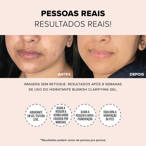 NUDESKIN BLEMISH CLARIFYING GEL MOISTURIZER